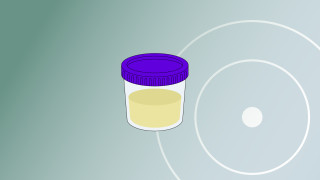 CoreMetabolomics Urine Analysis Hero